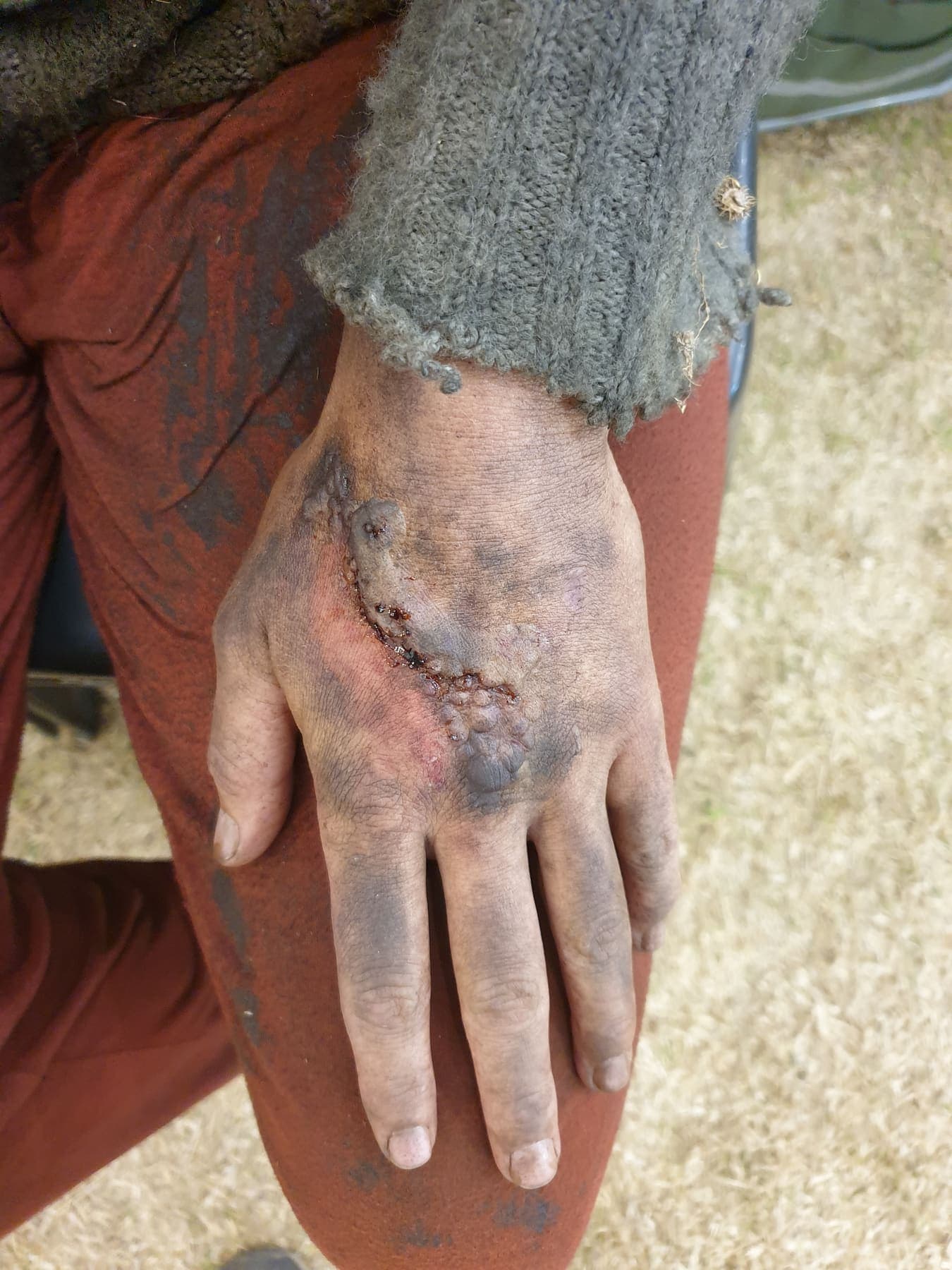 Horror Prosthetic by Amy Morgenrood, Cape Town sfx & prosthetics makeup portfolio