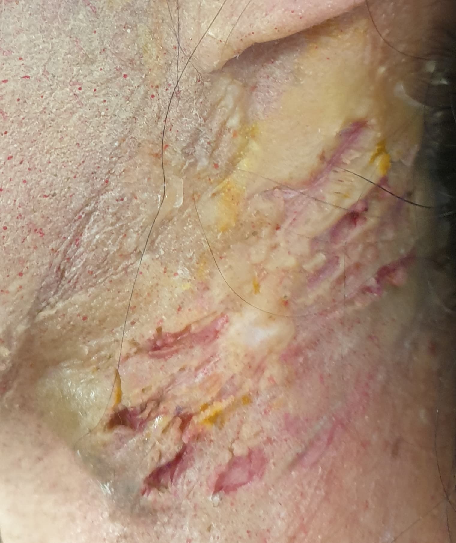 Horror Effect by Amy Morgenrood, Cape Town sfx & prosthetics makeup portfolio