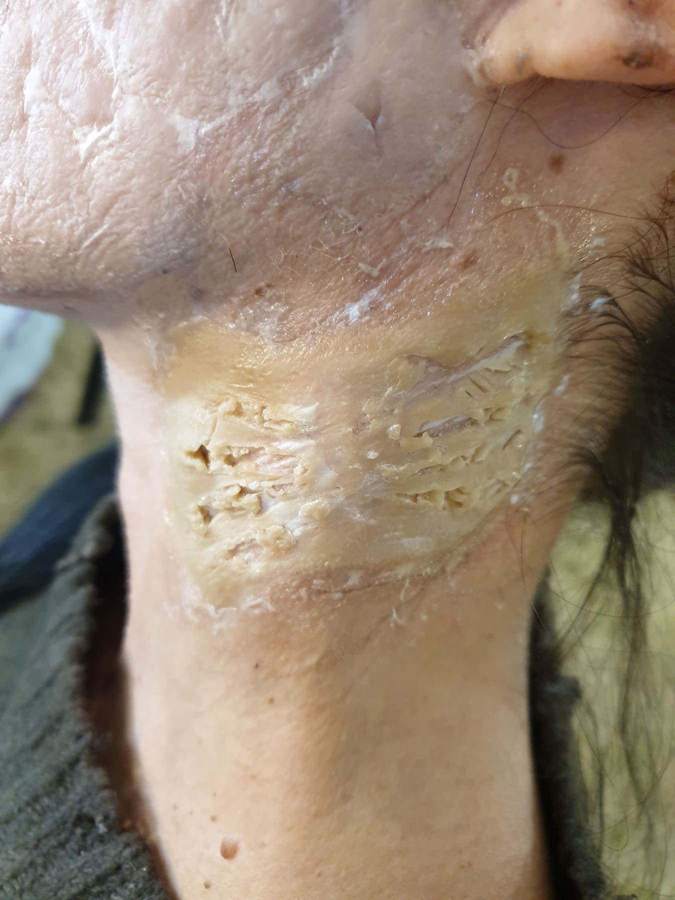 Wound Makeup by Amy Morgenrood, Cape Town sfx & prosthetics makeup portfolio