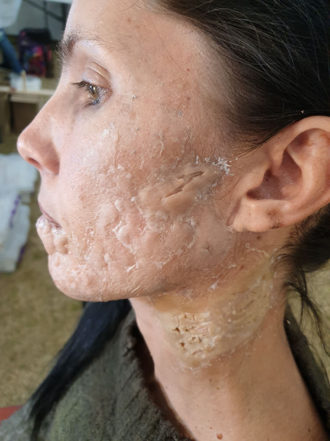 Scar Prosthetic by Amy Morgenrood, Cape Town sfx & prosthetics makeup portfolio