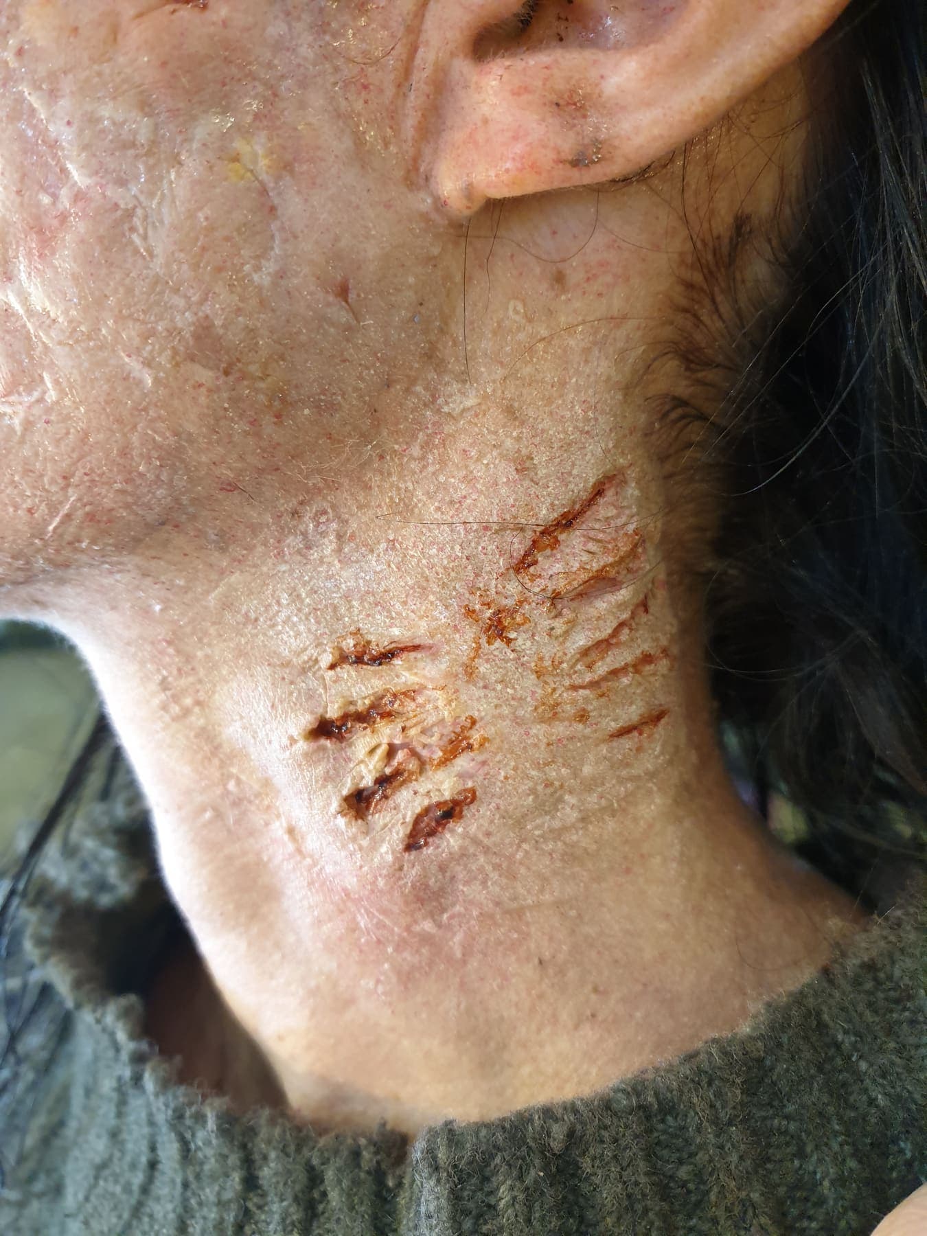 Horror Prosthetic by Amy Morgenrood, Cape Town sfx & prosthetics makeup portfolio